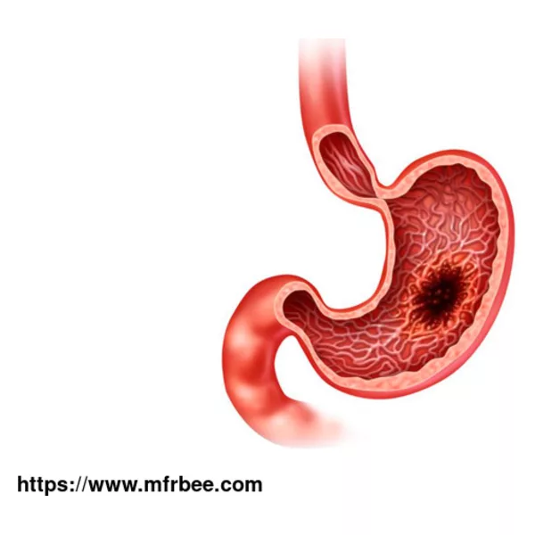 Individualized Medication Guidance for Gastrointestinal Cancer