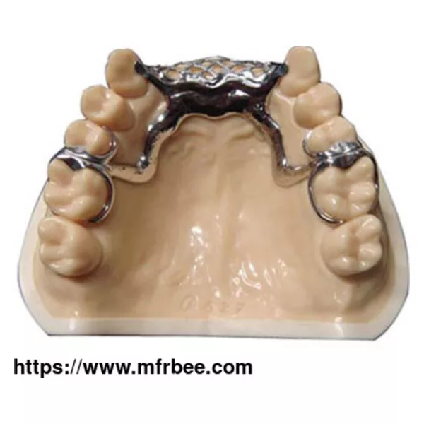 Metal Framework Vitallium Dental Removable Restoration