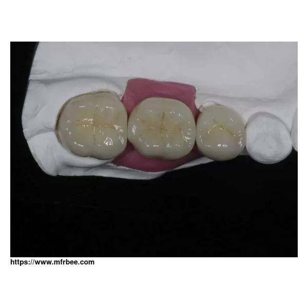 Dental-Implants china dental lab outsourcing