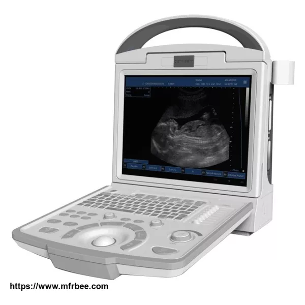 Canyearn A65 Full Digital Portable Ultrasonic Diagnostic System