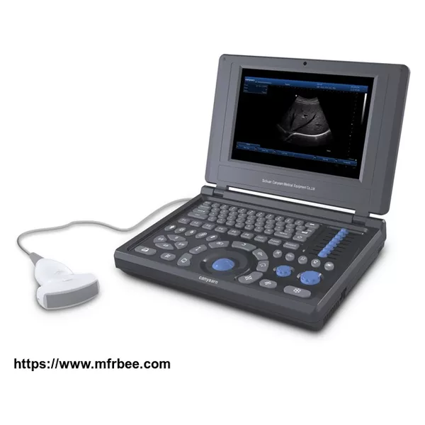 Canyearn A10 Full Digital Laptop Ultrasound Scanner