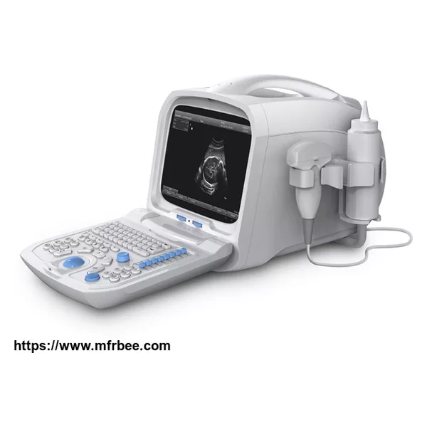 Canyearn A60 Full Digital Portable Ultrasonic Diagnostic System