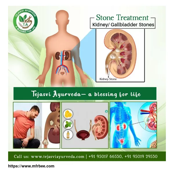 Kidney Specialist in Chandigarh