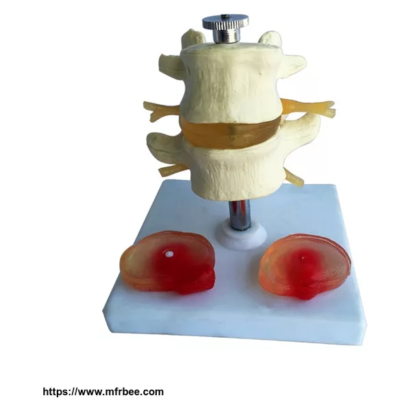 Medical Care Model Human Lumbar Intervertebra Disc