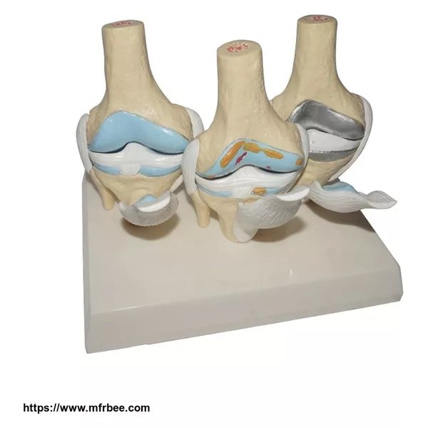 Human Knee Joint and Skeletal Anatomical Teaching Model