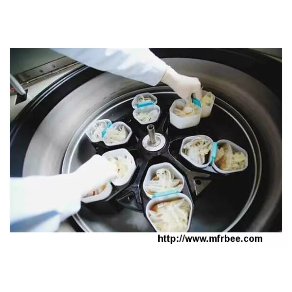 Plasmapheresis Method